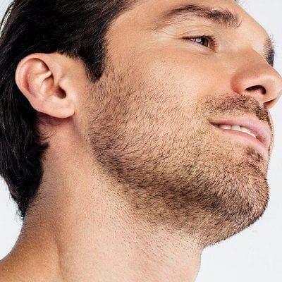 How Long Does Beard Transplant Take for Recovery?