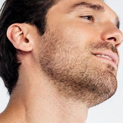 beard hair transplant in dubai