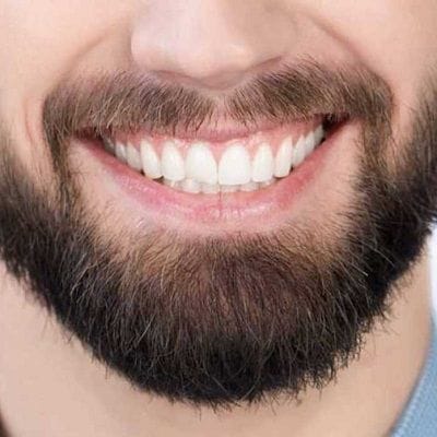 mustache hair transplant