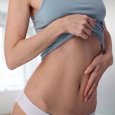 Bodytite Liposuction Cost in Dubai