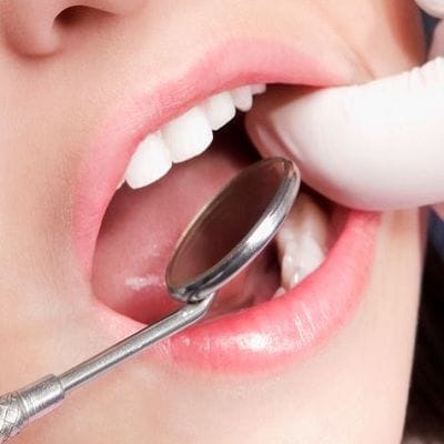 Dentist extraction in dubai