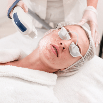 Laser Treatment for Scars Cost ,Procedure, Effectiveness, and More