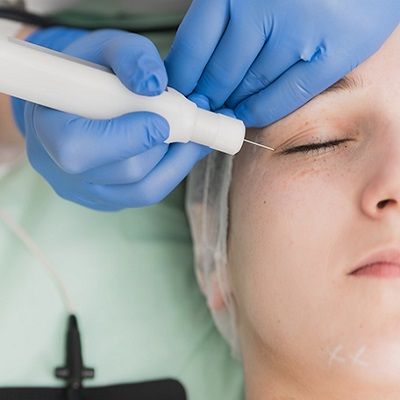 Plasma Pen Treatment Cost for Under Eye Wrinkles in Dubai