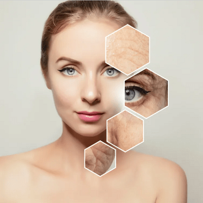 Top 5 Anti-Aging Treatments Cost in Dubai