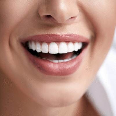 Hydrogen Peroxide Teeth Whitening Cost in Dubai