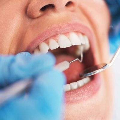 Root Canal Treatment in Dubai