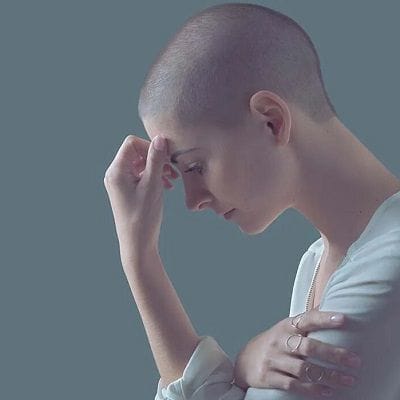 hair loss after chemo therapy