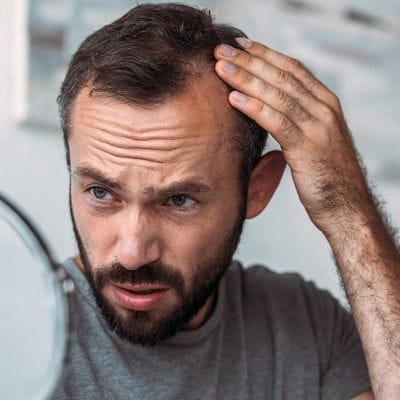 6 common hair loss causes in men