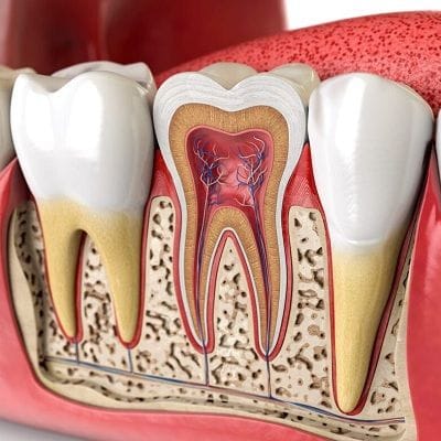 Best Dental Clinic for Root Canal Treatment in Dubai Abu Dhabi Ras Al Khaimah UAE