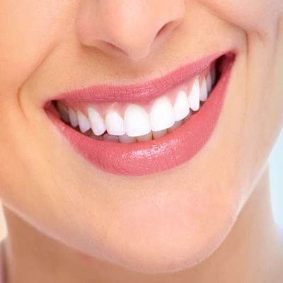 Best Smile Makeovers With Crowns In Dubai & Abu Dhabi