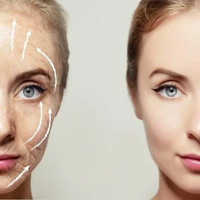 Botox Injections For Wrinkles Cost