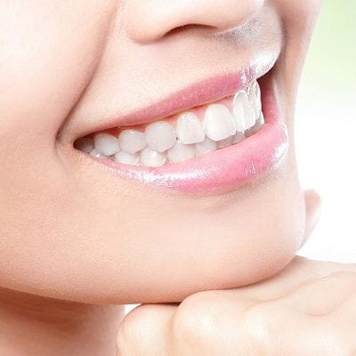 How Long Do E-Max Veneers Last?