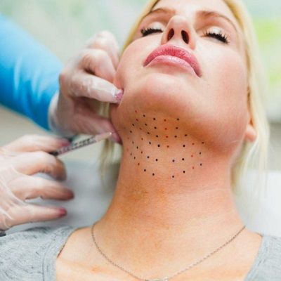 How To Get Rid Of Excess Chin Fat With Kybella in Dubai & Abu Dhabi