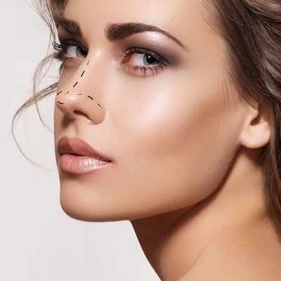 Non-Surgical Nose Job For Wide Nose