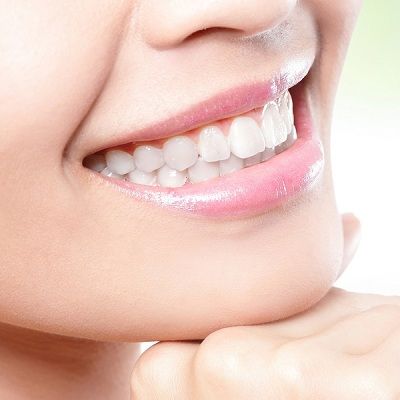 Teeth Whitening In Dubai Abu Dhabi Cost