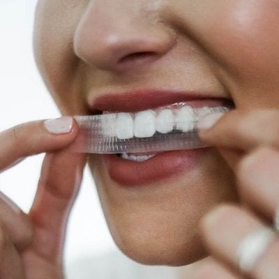 Are White Strips Safe on Tooth Enamel?