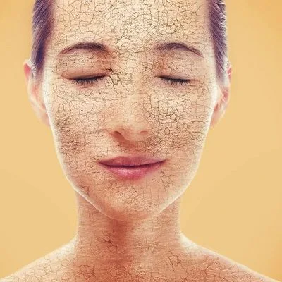 Best Skin Care Treatment for Dry Skin in Dubai - Diagnosis & Treatment