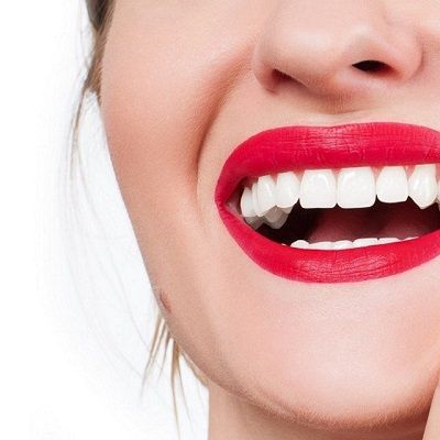 Do's And Don'ts After Teeth Whitening In Dubai,UAE Dynamic Clinic