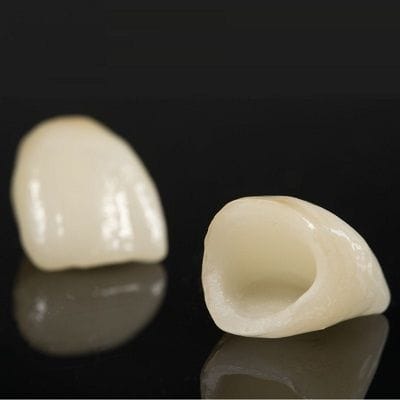 How Long Does A Ceramic Crown Last-Dynamic Clinic Dubai