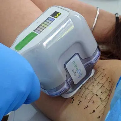 Miradry Treatment Cost