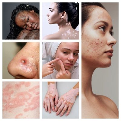 Skin Disorders Cured By A Dermatologist - Conditions Treated, Skin Procedures