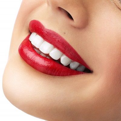 Teeth Whitening For Teens-Is It Safe-Dynamic Clinic Dubai