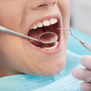 Dental Filling Treatment Options in Dubai
