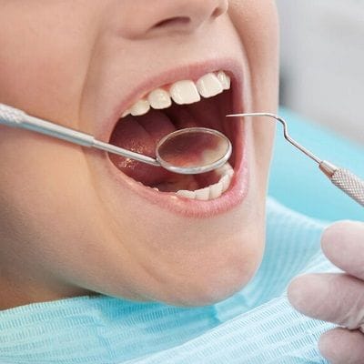 Dental Filling Treatment Options in Dubai