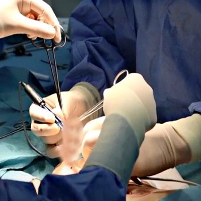 Male Circumcision Surgery in Dubai & Abu Dhabi - Dynamic Clinic
