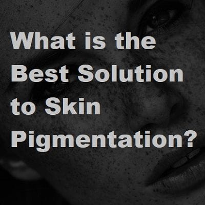 What is the Best Solution to Skin Pigmentation