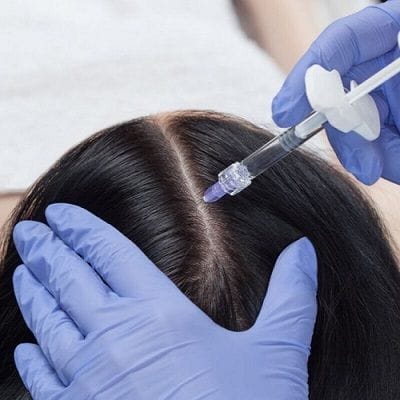 Hair Fillers How Does it Work in Dubai |Cost