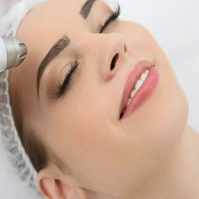 Laser treatment in Dubai