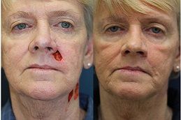 facial-reconstruction-surgery Clinic in Dubai