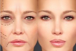 fillers-injection Clinic in Dubai