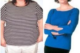 gastric-bypass in dubai