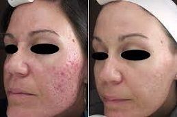 skin-rejuvenation Clinic in Dubai