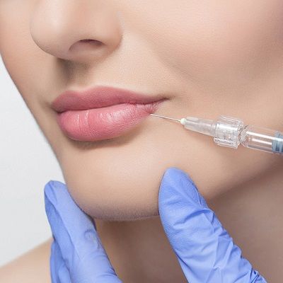 Lip Fillers injection in Dubai