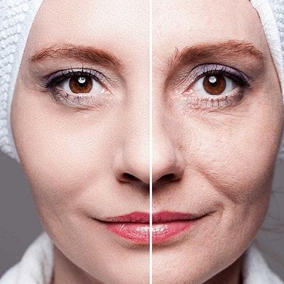anti aging treatment in dubai
