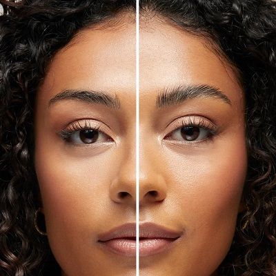 Types of Brow Lift Surgery in Dubai