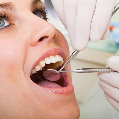 dental fillings in dubai UAE