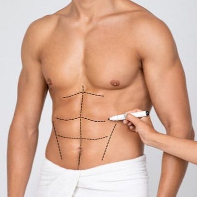 Cost of Six Pack Abs Surgery in Dubai | Price & Offers