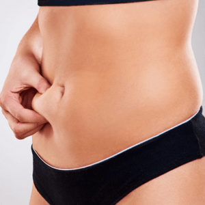Does Belly fat Come Back after a Tummy Tuck Surgery?