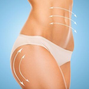 Does Liposuction Actually Remove Cellulite from your Body?