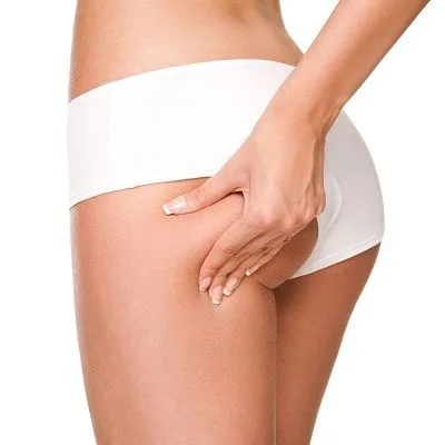 How Long Does it Typically Take to Recover from a Brazilian Butt Lift