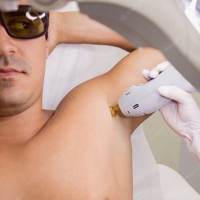 Laser Treatment in Dubai