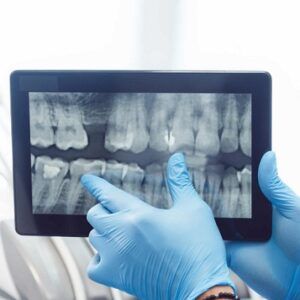Panoramic Dental X-Ray for BFP in Dubai