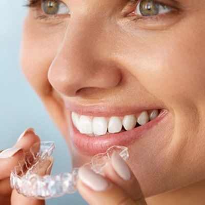 Teeth Aligners | Best Aligners in Dubai | Teeth Aligners Cost