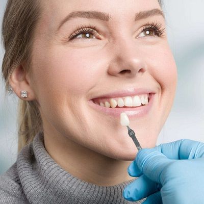 What Happens to your Teeth Under Composite Veneers?