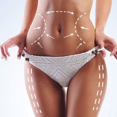 Why is Liposuction the Best Fat Removal Method