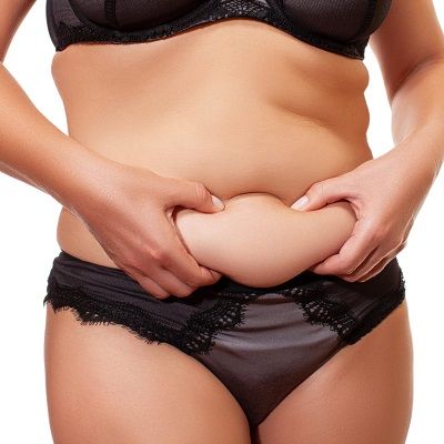 Body Lift Surgery: Everything You Need to Know